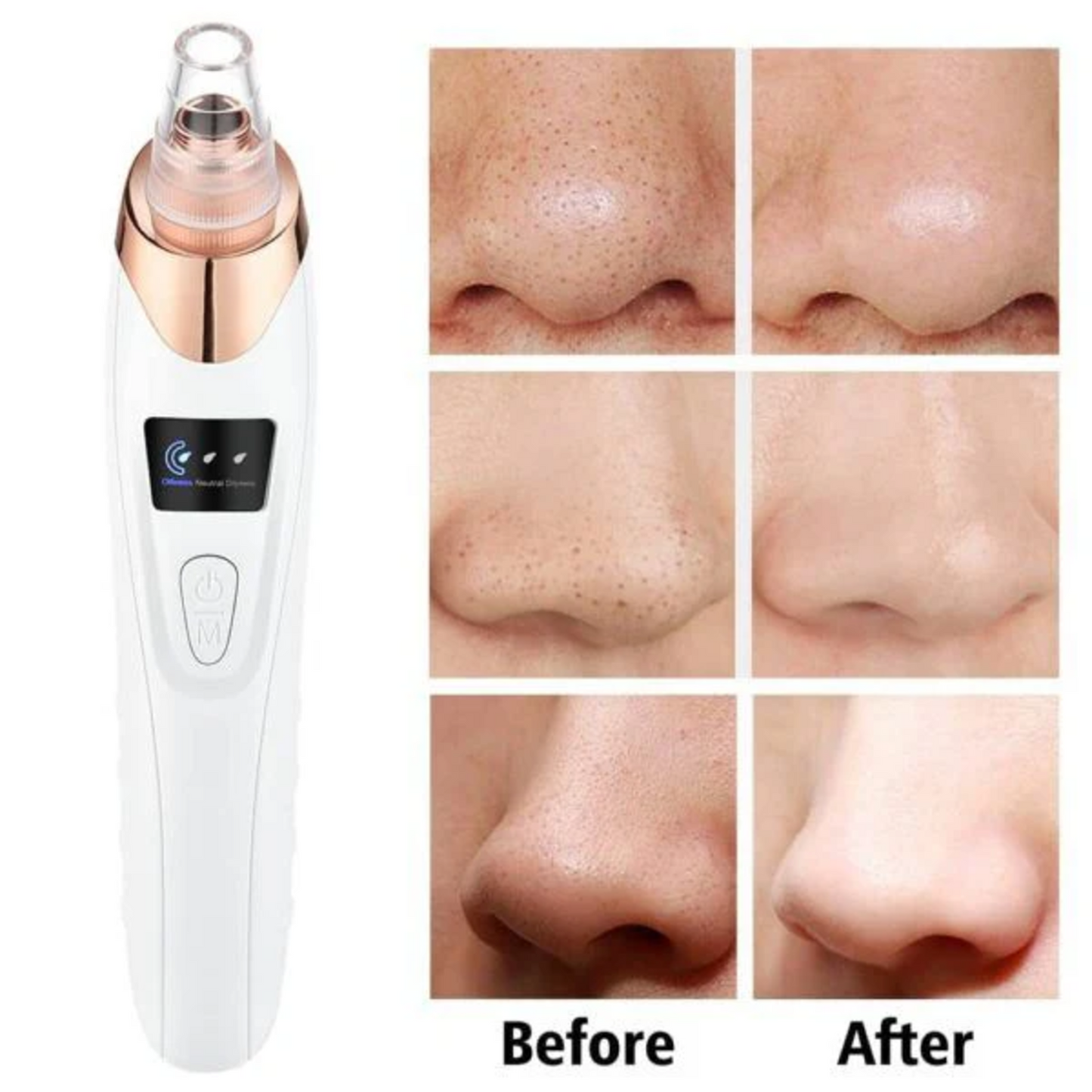 Premium Black Head Suction Machine
